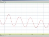 Valsalva Wave Report