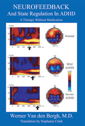 front cover of neurofeedback for ADHD book