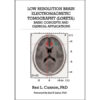 Low Resolution Brain Electromagnetic Tomography (LORETA) by Rex Cannon (Front Cover)