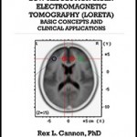 Low Resolution Brain Electromagnetic Tomography (LORETA): Basic Concepts and Clinical Applications