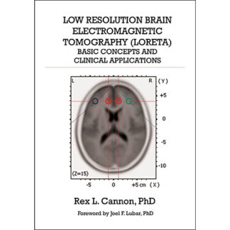 Low Resolution Brain Electromagnetic Tomography (LORETA) by Rex Cannon (Front Cover)