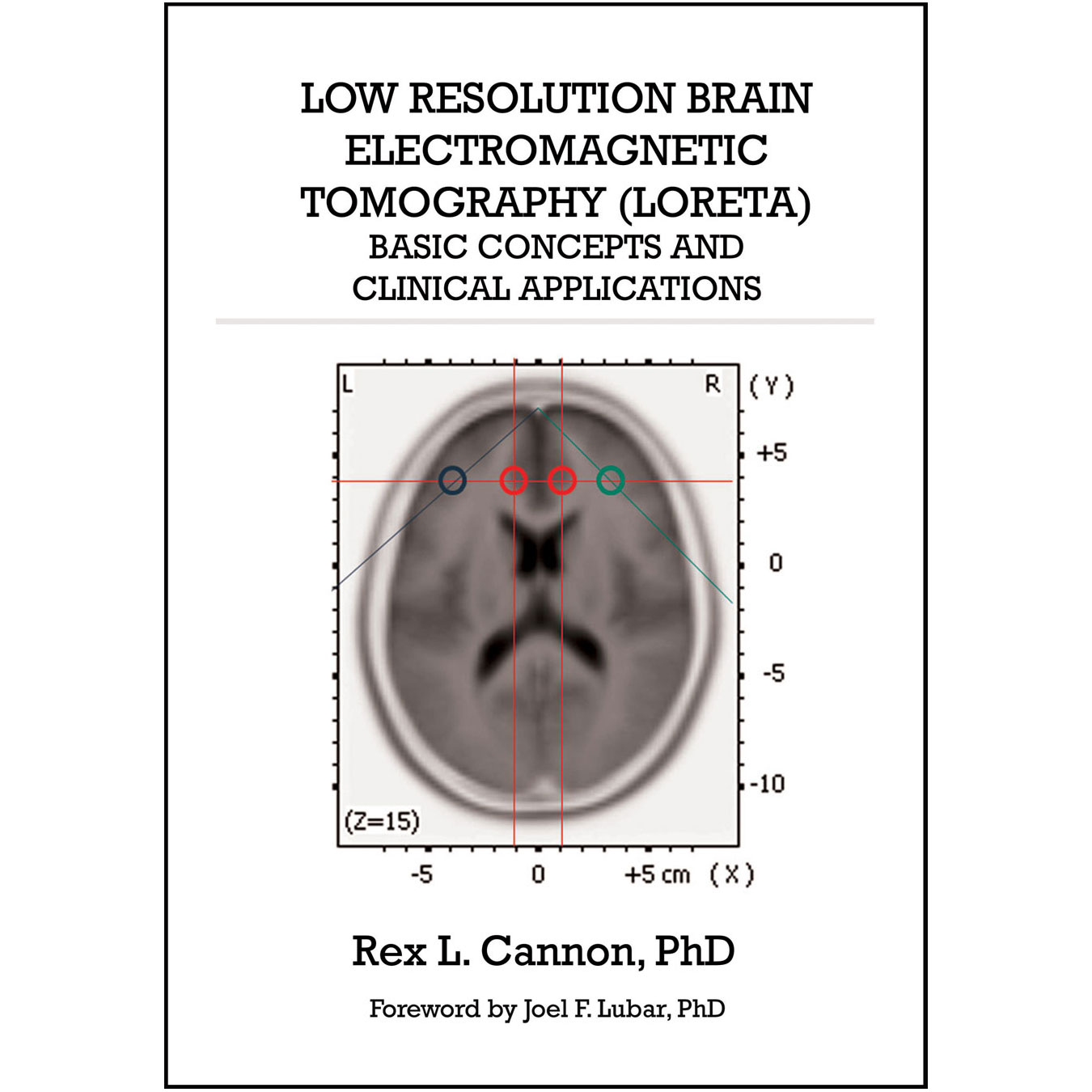 Low Resolution Brain Electromagnetic Tomography (front cover)