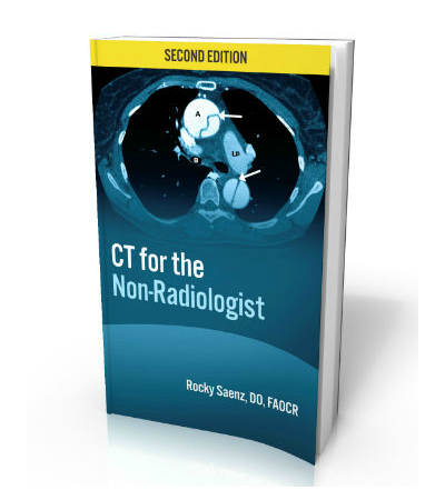 CT for the Non-Radiologist – The Essential CT Study Guide